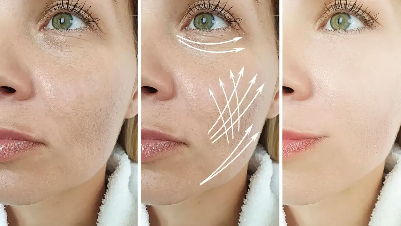 Can One Treatment Really Tackle More Than One Skin Concern Cheltenham?