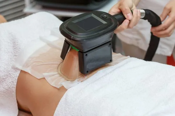Image of person having fat freezing treatment to help weight gain Cheltenham