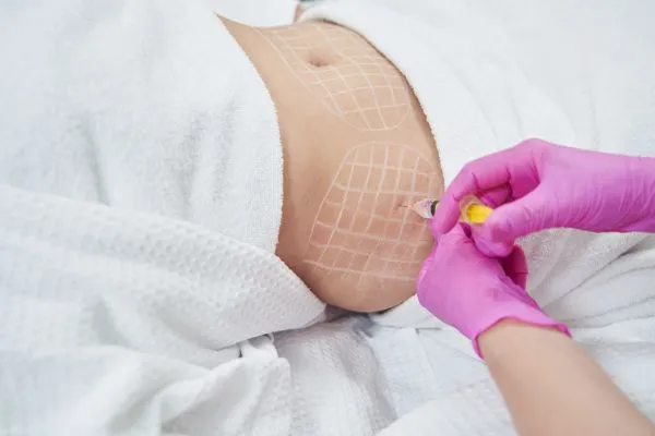 image of fat dissolving injections on love handles to help combat weight gain Cheltenham