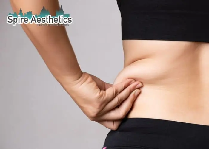 Image of woman pinching fat on their hips Cheltenham. Fat Freezing treatment
