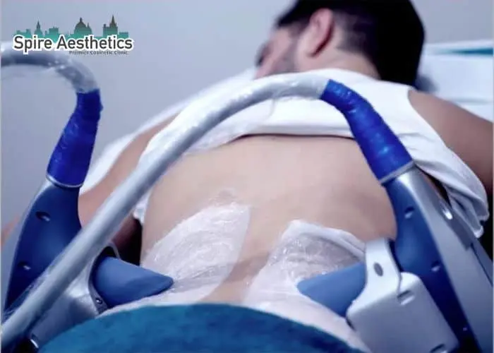 Man having fat freezing treatment done on love handles before a competitions Cheltenham to create a sculpted look.