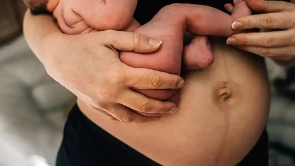 Why Is My Stomach Still Big After Pregnancy Cheltenham?