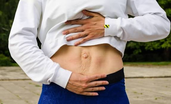 When Could Diastasis Recti Be the Missing Piece of the Puzzle Cheltenham?